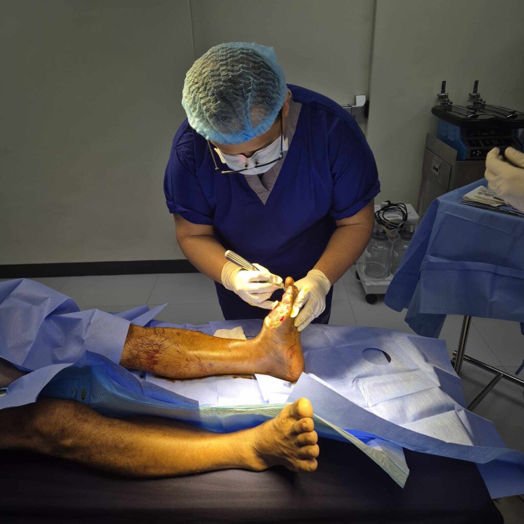 Debridement Services Quezon City – Expert Wound Care for Faster Healing