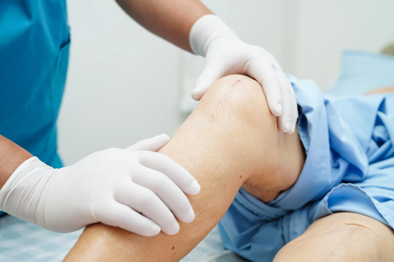 The Complete Guide to Affordable Knee Surgery and Recovery