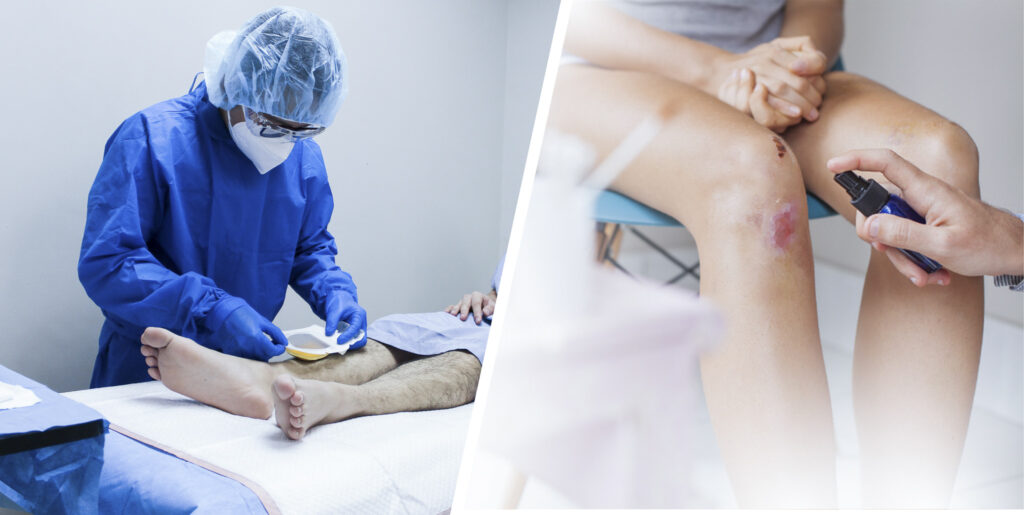Finding the Right Wound Care Specialist in the Philippines A Complete Guide for Patients and Families