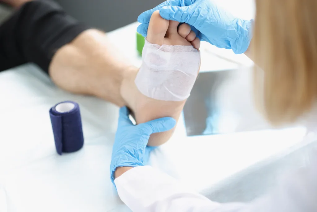 Orthopedic Treatment for Forefoot Ulcers Effective Approaches and Patient Care